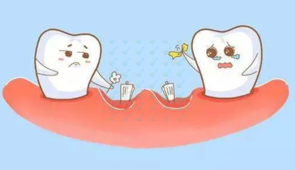 為什么每天都認(rèn)真刷牙，還是得“齲齒”了呢？齲齒是怎么形成的？