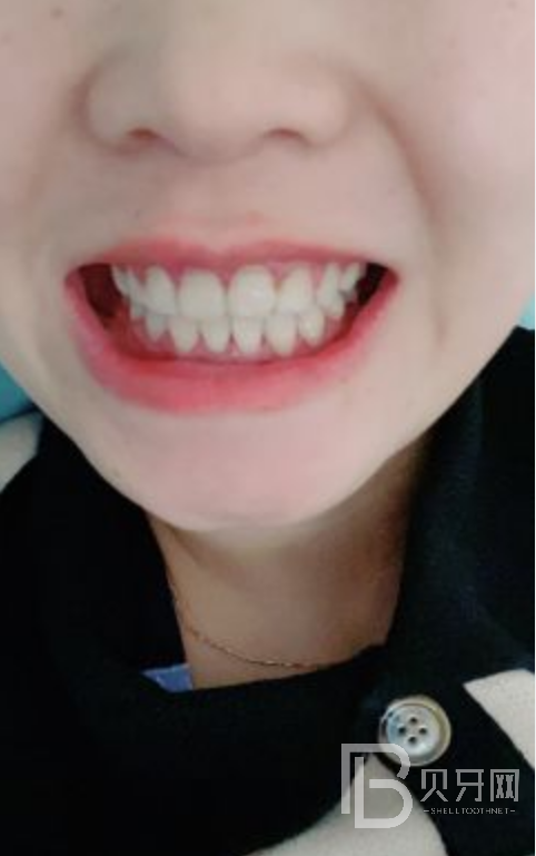 網(wǎng)友親身經(jīng)歷，齒康口腔做牙齒矯正怎么樣？靠譜嘛？