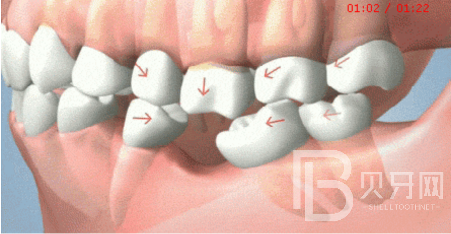 90%不知道，牙齒缺失后，盡然會出現(xiàn)這些癥狀！