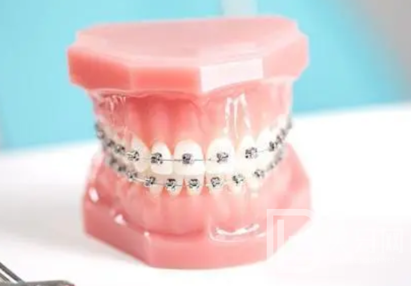 牙齒矯正為什么那么貴，牙齒矯正貴的原因是什么？