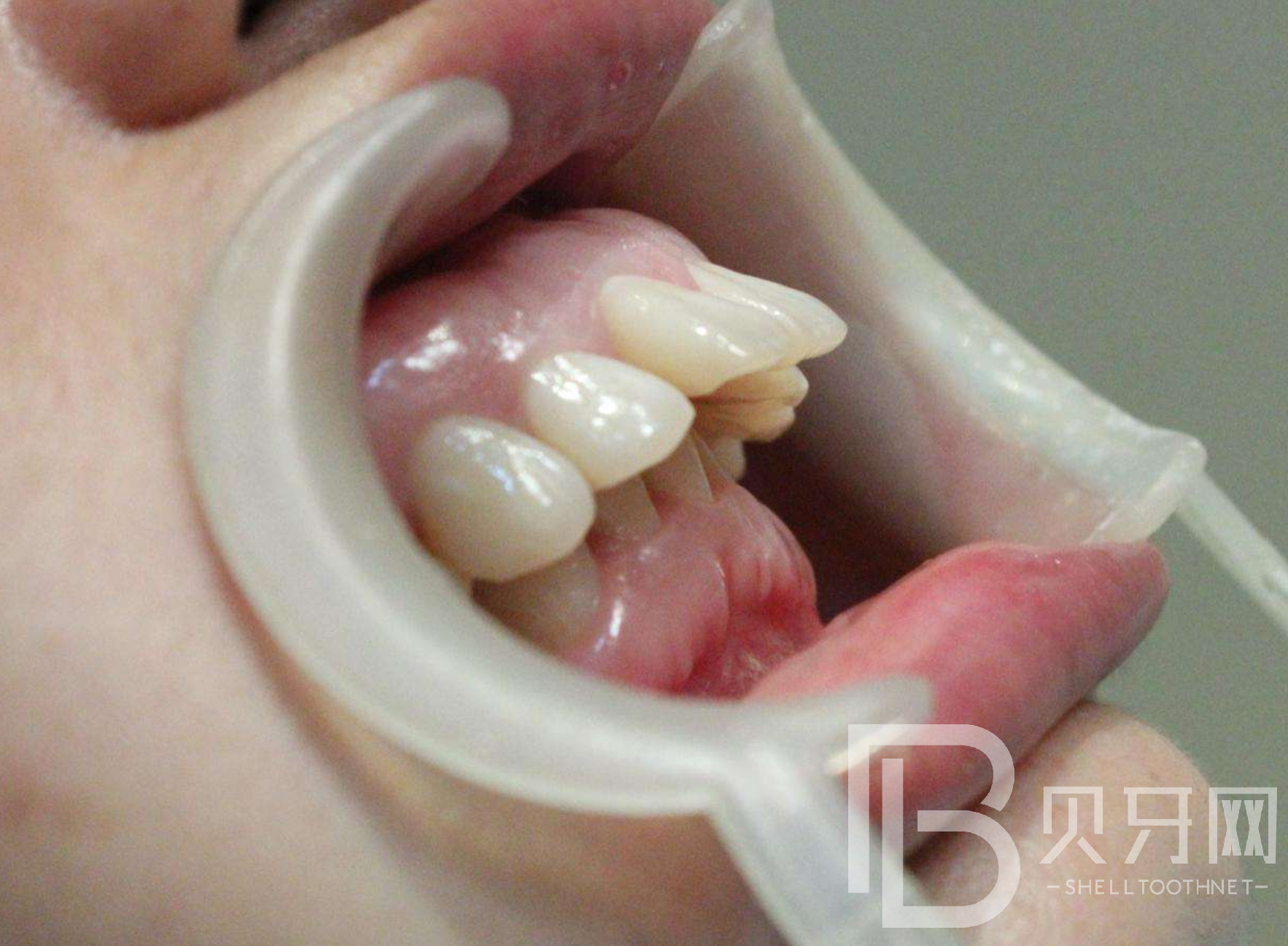 關(guān)于牙齒健康的4個秘密，你知道幾個？