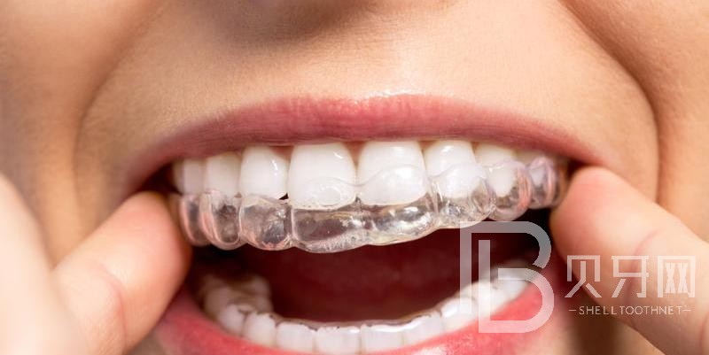 牙齒矯正后容易反彈嗎?這種情況需謹(jǐn)慎！