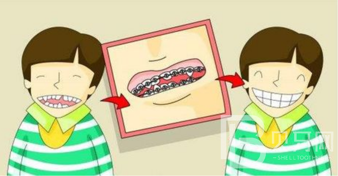 孩子牙齒不齊可以做牙齒矯正嗎？