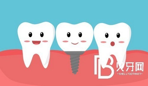 上海黃浦區(qū)種植牙價格表，種牙好又便宜的牙科