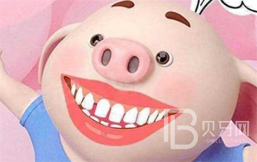 2022新版上海牙齒矯正價(jià)格表，上海哪家醫(yī)院牙齒矯正好？