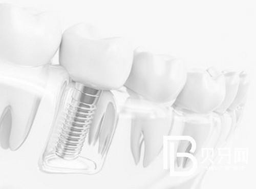 盤點北京牙齒矯正好口碑醫(yī)院，這幾家值得一去！