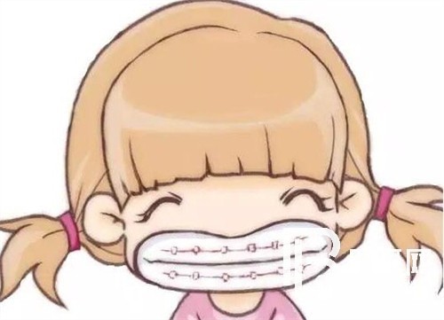 上海鑫齒口腔牙齒矯正好嗎？時(shí)代天使和隱適美有效果差別嗎？