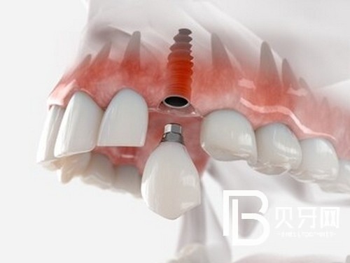 北京京一口腔怎么樣？醫(yī)院簡介優(yōu)勢項目統(tǒng)統(tǒng)都有！