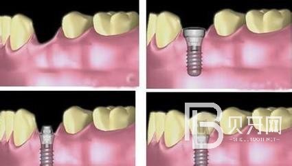 北京固爾口腔怎么樣？收費怎么樣？