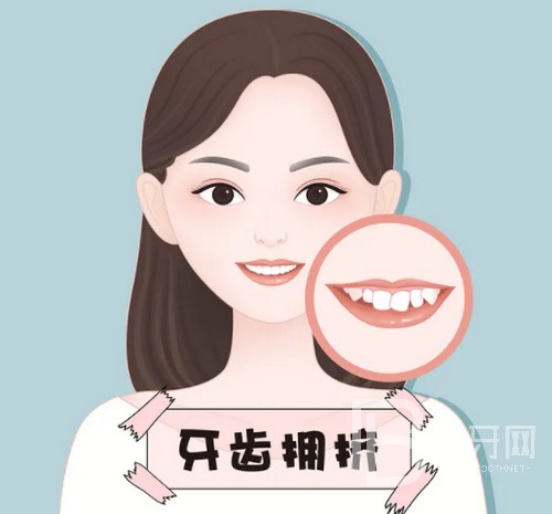 北京牙齒矯正大概要花費(fèi)多少錢(qián)？公布2022年北京牙齒矯正價(jià)目表