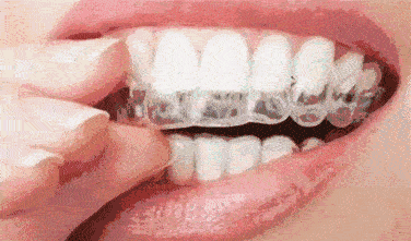 北京中諾口腔醫(yī)院種植牙技術(shù)好的醫(yī)院，好口碑不是空穴來(lái)風(fēng)