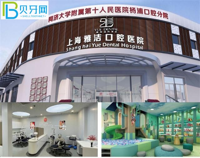 上海雅潔口腔醫(yī)院怎么樣 正規(guī)私立口碑好嗎收費(fèi)貴嗎