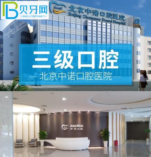 北京中諾口腔真實(shí)評價