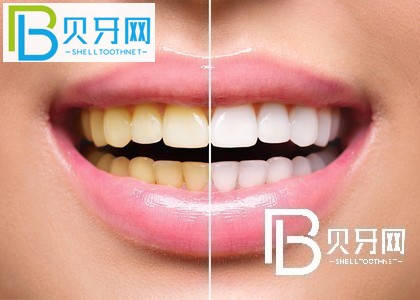 上海瑞爾齒科怎么樣？口碑如何？附上海各門店地址