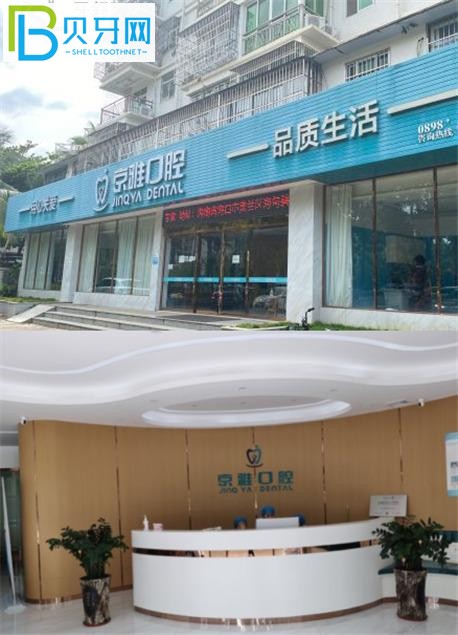 海口京雅口腔收費(fèi)標(biāo)準(zhǔn)價(jià)格表