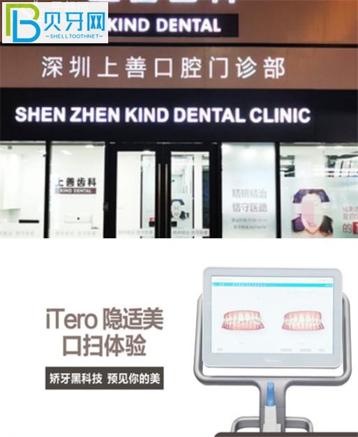 深圳上善齒科收費標(biāo)準(zhǔn)價格表