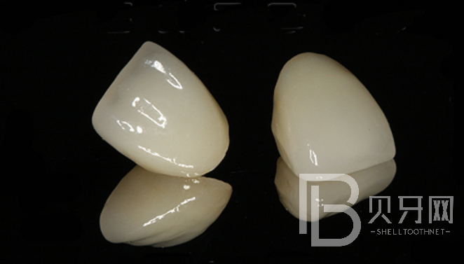 成都牙米口腔正規(guī)嗎？種植牙實(shí)力醫(yī)生推薦