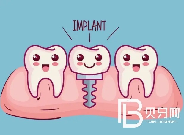 廣州柏德口腔種植牙好不好？收費(fèi)貴不貴？