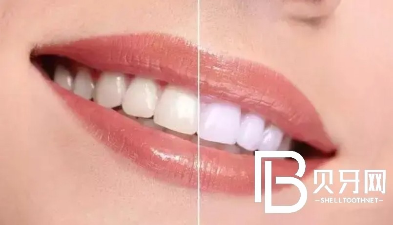 武漢雅貝康口腔怎么樣？醫(yī)生實力如何？