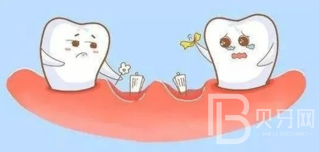 北京鈦植口腔上半口種植牙六顆好還是八顆好？