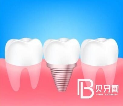 杭州博泰口腔口碑怎么樣？醫(yī)院正規(guī)嗎？