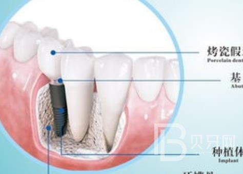 廣州優(yōu)德口腔正規(guī)靠譜嗎？廣州優(yōu)德口腔醫(yī)院位置在哪？