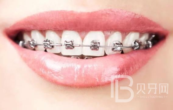 廣州明瑞口腔怎么樣？廣州明瑞口腔口碑好不好？廣州明瑞口腔種植牙多少錢