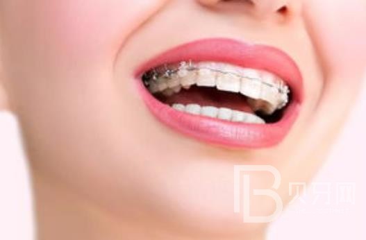 廣州潤博口腔正規(guī)靠譜嗎？廣州潤博口腔醫(yī)院位置在哪？