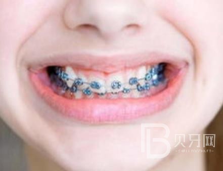 廣州團圓口腔怎么樣？廣州團圓口腔種植牙一顆多少錢