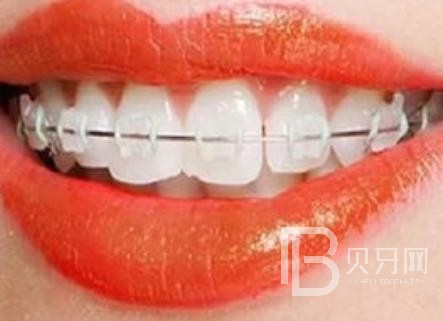 廣州愛(ài)頓口腔怎么樣？廣州愛(ài)頓口腔口碑好不好？廣州愛(ài)頓口腔種植牙價(jià)格