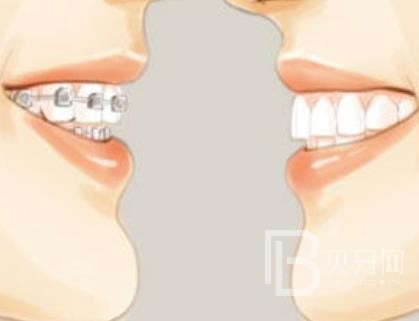 廣州雅皓口腔正規(guī)靠譜嗎？廣州雅皓口腔醫(yī)院位置在哪？