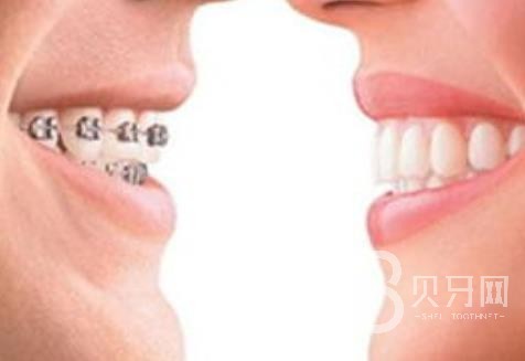 廣州歐立口腔怎么樣？廣州歐立口腔口碑好不好？廣州歐立口腔種植牙價(jià)格