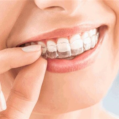 杭州種一顆牙齒要多少錢！浙江富陽康順口腔2023全新種牙價目表，國產(chǎn)常州創(chuàng)英種植牙：4703元起/顆！