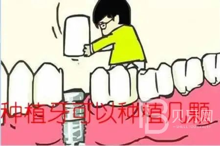 allon6種植牙是什么意思？東莞拜爾口腔