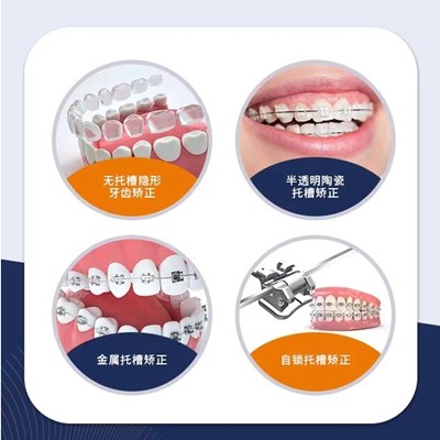 衢州冷光美白整牙醫(yī)院排名前十預(yù)測(cè)！衢州王江濱口腔收費(fèi)都不貴的