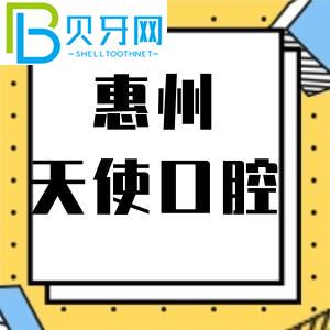惠州天使口腔門診怎么樣？市民說活動價格不貴。